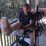 I Broke my Leg!